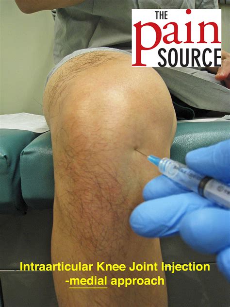 how to give knee injection